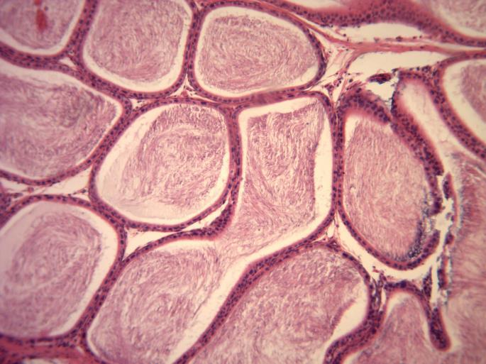 para dentro das células. Com lamina basal cercada por células musculares lisas e tecido conjuntivo frouxo com células musculares lisas.