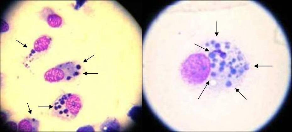 CAPITULO I 32 Figura 3 - Fotomicrografias de células DH82 provenientes de monocamada inoculada com o isolado de Jaboticabal, SP apresentando mórulas de Ehrlichia canis (setas) aos 28 dias