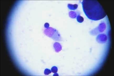 CAPITULO II 47 adaptação em cultivo celular, este isolado passou a atingir 90-100% de infecção dentro sete dias após a inoculação.