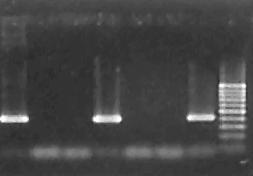 Panótico rápido (Laborclin ); 100X 1 2 3 4 5 6 7 8 409 pb Figura 2 Eletroforese em gel de agarose (1,5%) dos produtos amplificados do gene dsb das monocamadas de