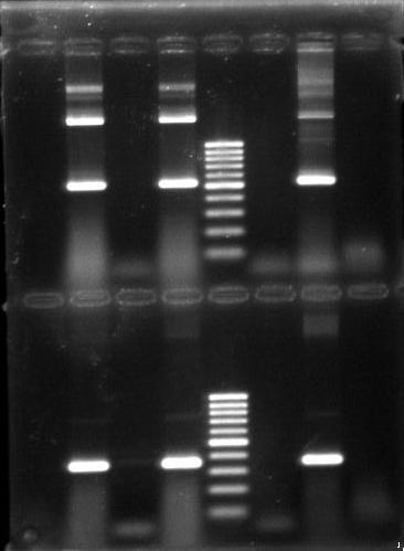 CAPITULO II 48 3.3 SEQÜENCIAMENTO O presente isolado apresentou-se positivo na PCR dos genes 16S rrna e P28 conforme o esperado (Figura 3).