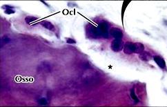 Osteoclastos Grandes células multinucleadas com bordas pregueadas