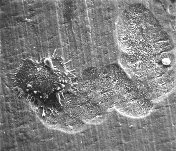 Ocupam uma lacuna de Howship derivados de precursores da medula