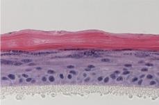 Capacidade de formar epiderme 3D Desenho do estudo Comparação de epiderme 3D formada por passagem precoce (jovem) e por células