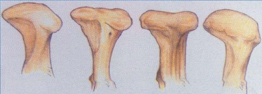 O côndilo mandibular tem morfologia muito variada, sendo no entanto, sempre convexa em todos os planos.