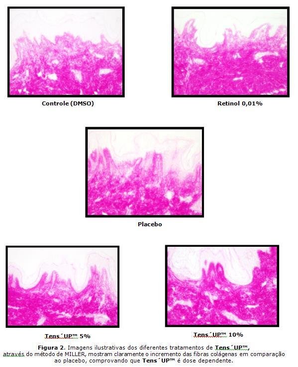 Podemos concluir com base nos resultados nos testes de eficácia que Tens UP é um ativo inovador de efeito lifting imediato, uma vez que sua ação de tensão superficial acrescenta atividade antiaging