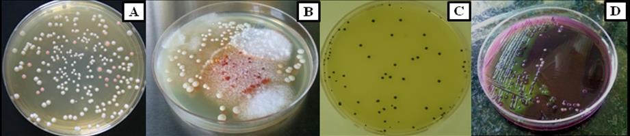 Figura 1. Micro-organismos isolados na UAN hospitalar: Mesófilos (A); bolores e leveduras (B); Staphylococcus sp. (C) e E. coli (D).