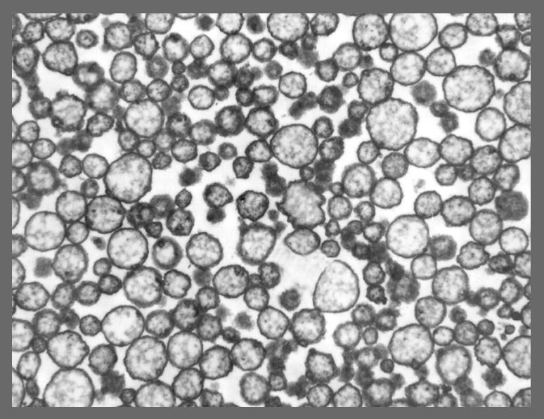 Ocorrendo perda das camadas de superfície dos lipossomas formaram-se partículas de diâmetros maiores, podendo variar de 2µ a