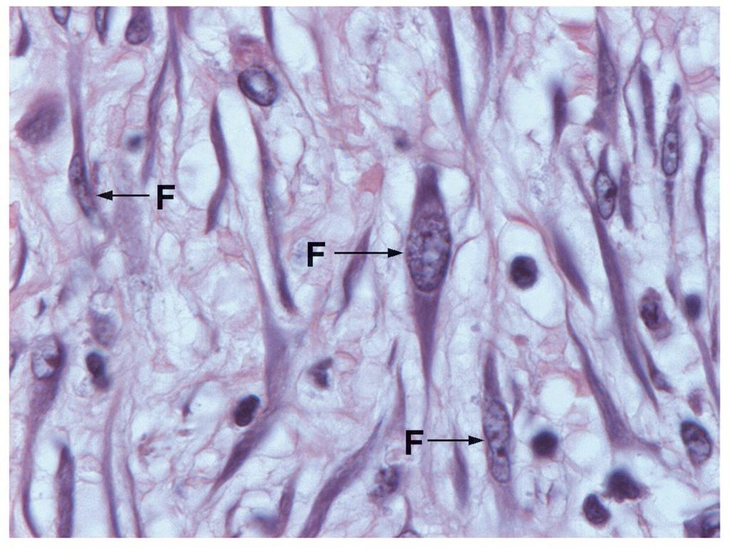 Fibroblastos: células que sintetizam e secretam matrix extracelular na qual está imersa Fibroblastos ativos em um tecido