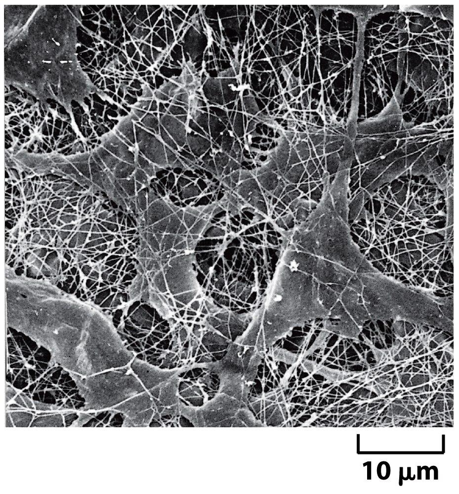 Fibroblastos em tecido conjuntivo Microscopia Eletrônica de