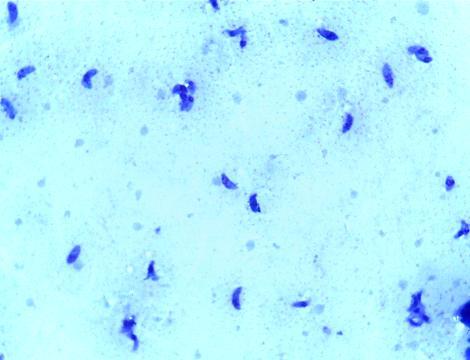 A B C Figura 1: A-Taquizoíto de Toxoplasma gondii em lavado peritoneal de camundongos Balb/c, corados pelo Panótico.