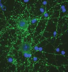 neurites e a sinaptogénese Controlo Microscopia da epifluorescência da