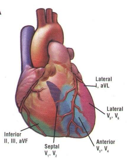 avr avl DI DIII avf DII