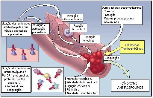 24 Figura 2 Mecanismos patogênicos na síndrome antifosfolípide (HANLY, 2003).