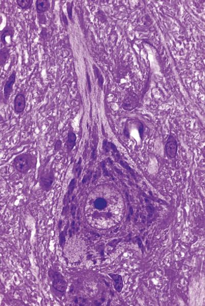 Corpo Celular do Neurônio Corpúsculo de Nills (acúmulo de