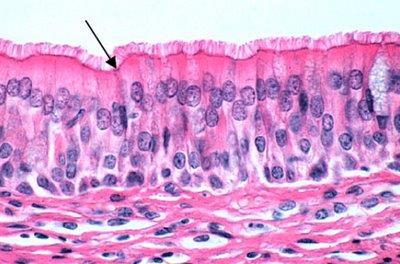 (membrana basal).