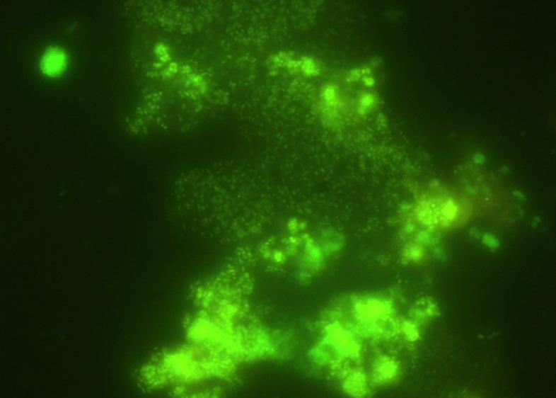 Fig 9: Bactéria Nitrito-Oxidante (BNO) dentro poro Fig 10: Ambas as populações em uma foto do (BAO em vermelho e BNO em verde) Levando-se em conta o elevadíssimo desempenho de biodegradação da mídia