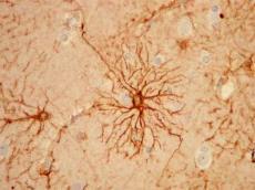 células que sustentam o neurônio e auxiliam no seu funcionamento.