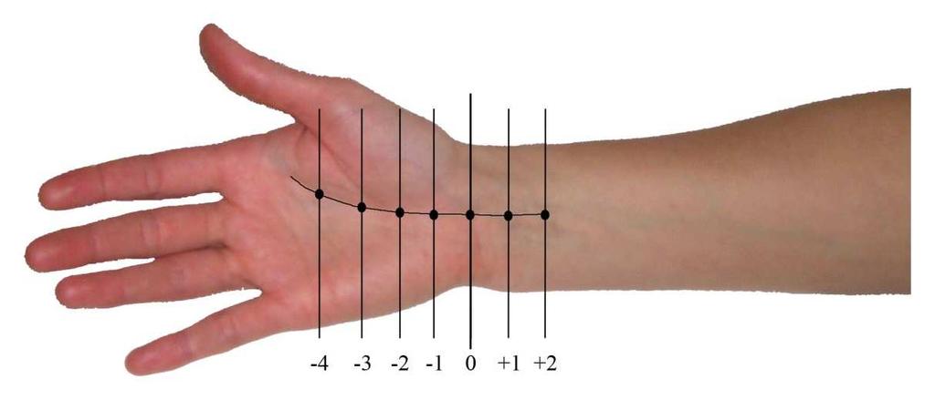 Método de realização 1. Selecione o segmento do nervo que será estudado levando em consideração a sua acessibilidade para a estimulação (ponto de captação) 2. Selecione a linha zero (linha de base).