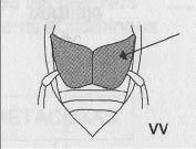 Metacoxas de Haliplidae (Retirado Figure 6. Metacoxae of Haliplidae (after Figura 7.