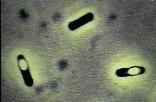 Bactérias Grampositivas (6060 bar) Staphylococcus aureus Streptococcus faecalis Micrococcus sp.
