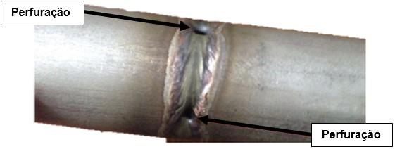 Em casos onde a abertura de raiz apresenta variações dimensionais ao longo da junta, pode-se observar perfurações de solda em regiões onde a abertura for maior, provocando dessa forma metal escorrido