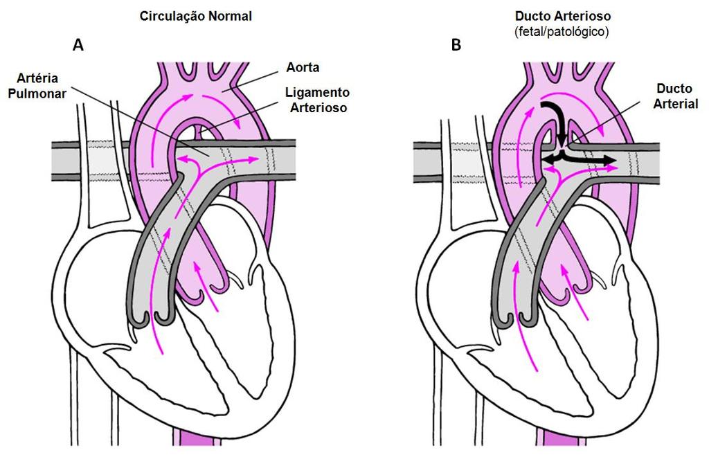 20 Após o nascimento, com a interrupção da passagem de sangue da placenta para o feto, a oxigenação passa a ser função designada pelo aparelho respiratório (SILVA, 2010; OYAMA et al., 2010).