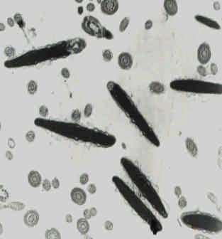 (a) Fresh spermatozoa presenting an intact acrosome and a plasmalemma in close