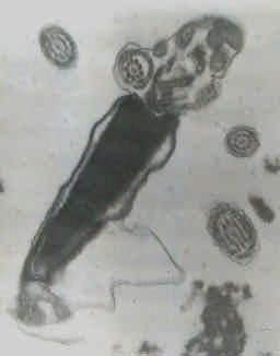 144 A A N PM N OM (a) MP (b) E Figure 3. Transmission electron micrograph of dog spermatozoa after cryopreservation with ACP 106.