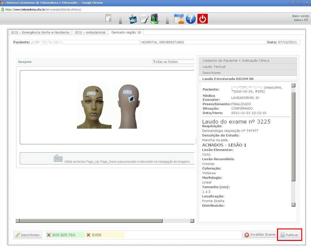 1.22 Se o laudo já foi preenchido completamente, basta clicar agora em Publicar, o