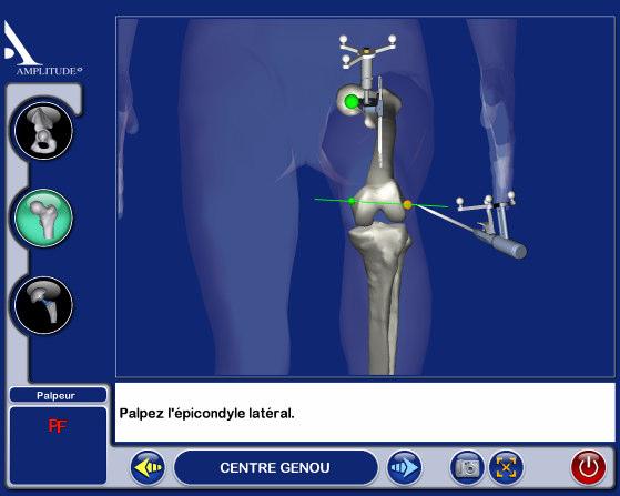 Uma posição incorreta acarretará um erro na angulação (antiversão) dos implantes. 4.