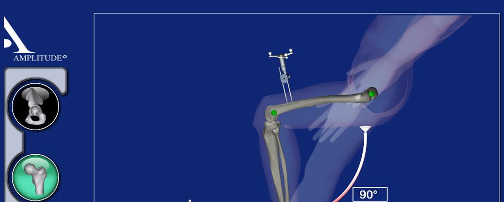 contralateral e sinfisis púbica. 5.