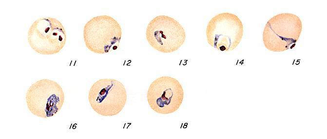 Malária: incidência no Distrito de Aveiro 29 Os trofozóitos do P. falciparum tendem a permanecer em forma de anel, mas podem tornar-se mais espessos e compactos.