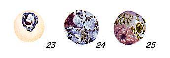 Malária: incidência no Distrito de Aveiro 33 parasitado e, após um curto período de vida livre, no plasma sanguíneo, invadem novos GV ( Figura 15) (Coatney et al., 1971; Faust, 1975). Figura 15. Esquizontes de P.