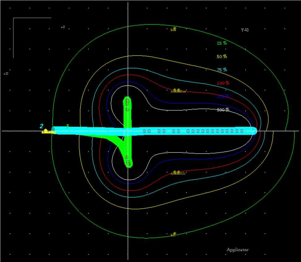 Ziegler MultiSource