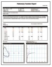 000 PC portátil com características que suportem o equipamento e o software de espirometria: 1000 TOTAL POR UNIDADE OPERACIONAL de ESPIROMETRIA: 2500 (espirómetro+grelhas+software+pc