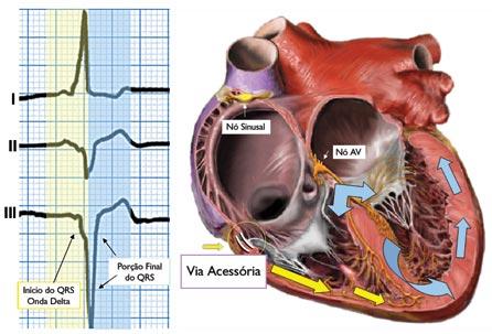 Arritmias, mal súbito e coração: - - arritmias diversas - pacientes com doenças cardíacas (infarto do miocárdio, insuficiência cardíaca, doença de Chagas, miocardiopatia hipertrófica, doenças
