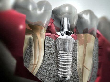 A cirurgia dependerá de muitos