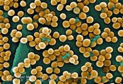 Lactobacilos Micobactéria Cabeça de hemolítica aereus