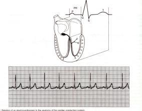 LEITURA DE ELECTROCARDIOGRAMA Para que se possa identificar um traçado cardíaco, seis questões fundamentais: Há actividade eléctrica? Qual a frequência ventricular?