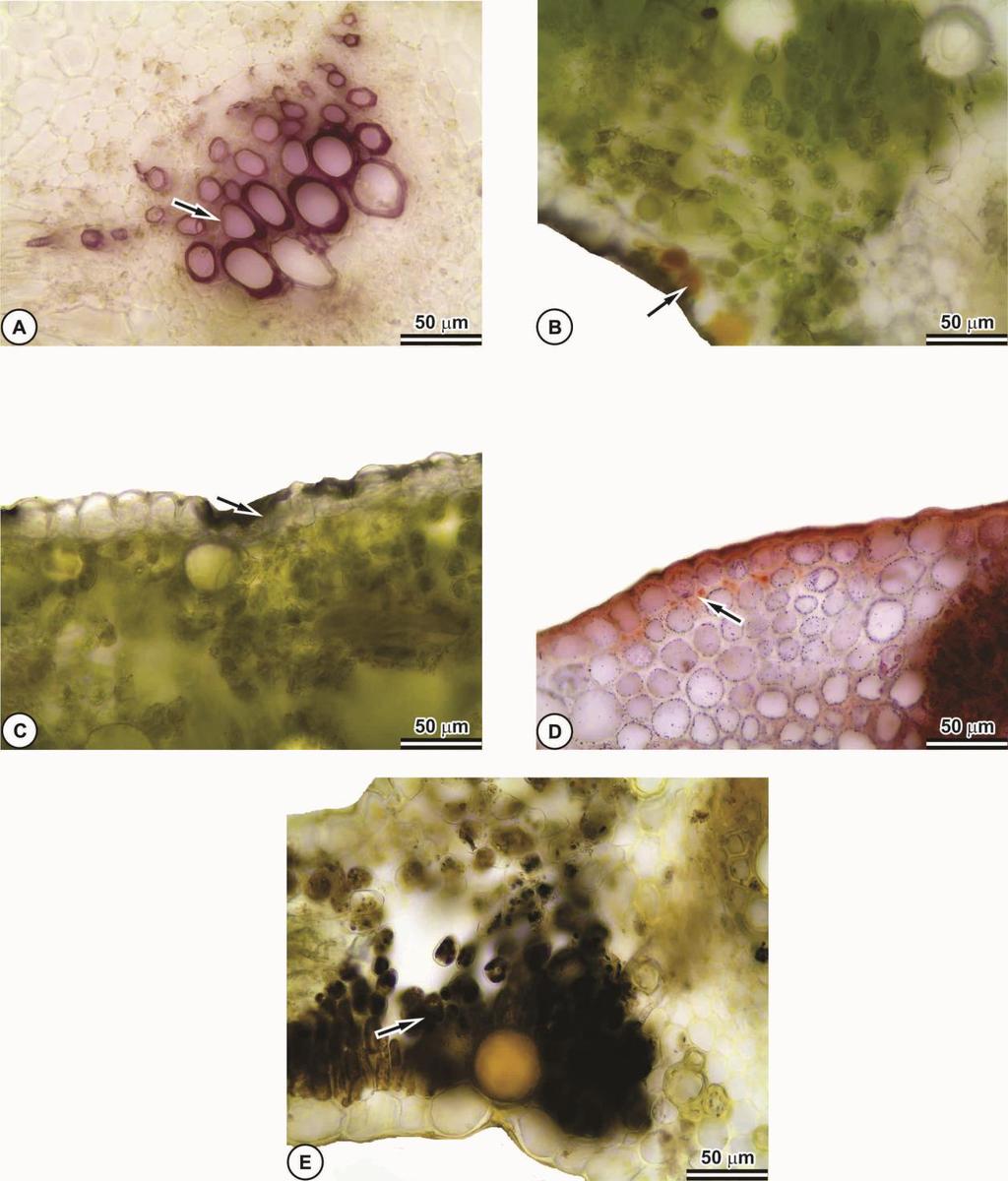 Figura 3. Testes histoquímicos em secções transversais da folha de Aristolochia cymbifera. A; lignina (roxo).