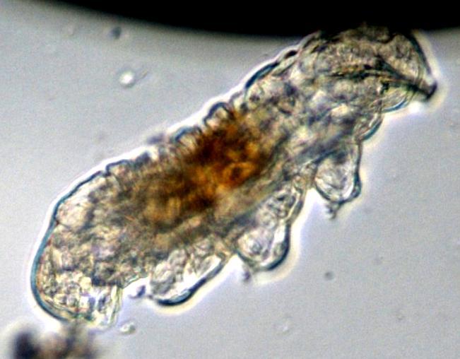 como já foi discutido nos resultados microbiológicos para a areia lavada onde a mesmo apresentou diversas espécies parasitas intestinais.
