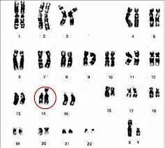 Como cromossomos são visualizados e representados Cariótipo Cromossomos organizados aos pares a partir de uma visão ao microscópio de