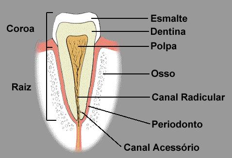 Exemplos de Expansão Térmica (2) Quando uma cavidade em um dente é preenchida, o material utilizado na restauração deve ter as mesmas propriedades de expansão térmica que o dente ao seu redor; de
