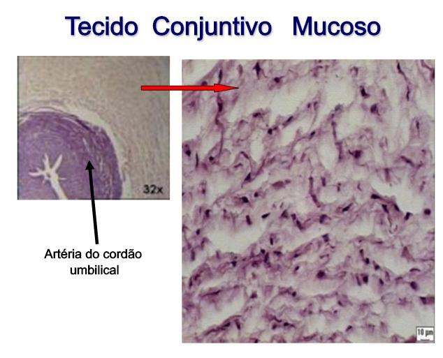 Tecido conjuntivo Embrionário Predomínio de matriz extracelular; Mucoso: Tecido frouxo encontrado no cordão