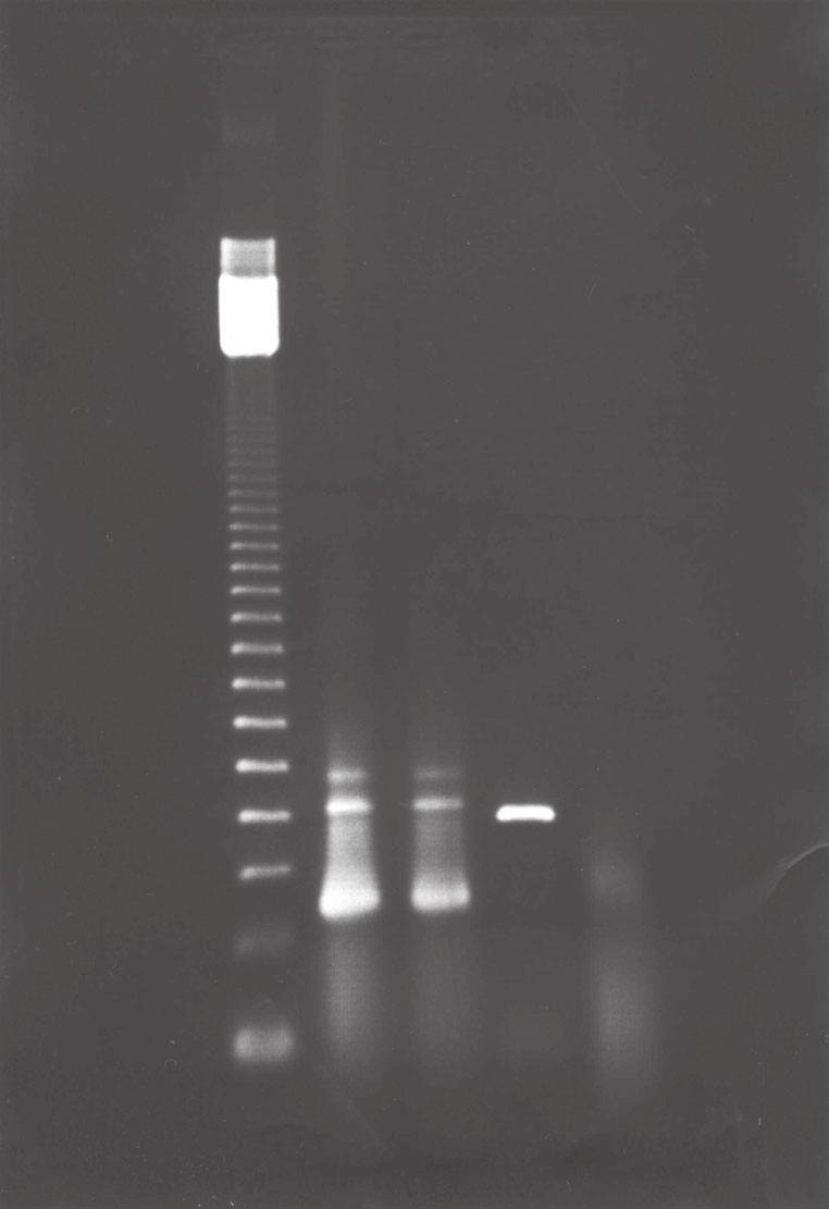 DEN-3 no Por meio do método de nested RT-PCR, segundo Lanciott et al.