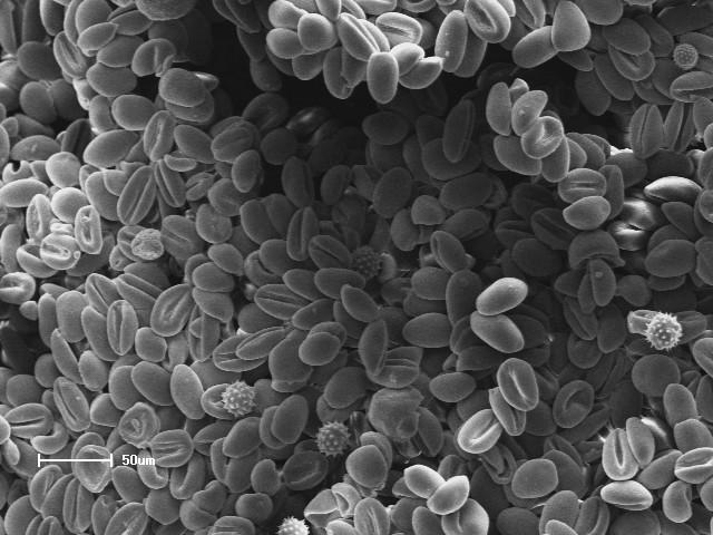 Comparando-se as imagens obtidas nesse trabalho com as obtidas por Carpes, pode-se observar que o pólen dominante foi de Arecaceae tipo I e de Asteraceae eupatorium em menor quantidade, tanto no