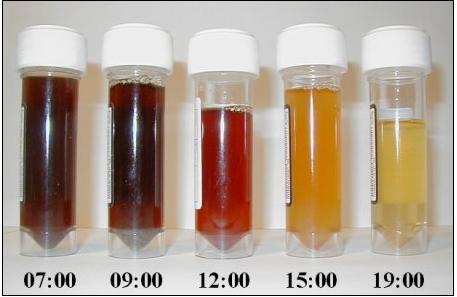 Teste de HAM Soro acidificado ativa a via alternativa do complemento resultando na lise das