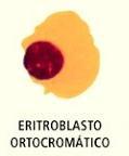 Maturação dos eritrócitos - 3 Eritroblasto Policromático: célula ainda menor; - Contém hemoglobina (cor rosa); - 4
