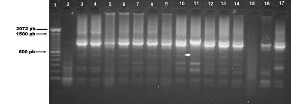 µl. Foram testadas diversas concentrações de DNA genômico (5ng, 10ng, 15 ng e 20ng) na reação, bem como diferentes temperaturas de anelamento e extensão durante a amplificação.